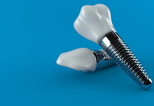 Dental implant on a blue background