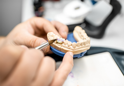 Dental professional holding a 3D printed model of the teeth
