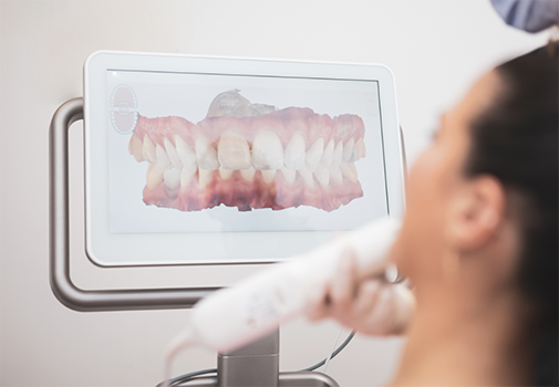 Dentist capturing digital scans of a patient's teeth