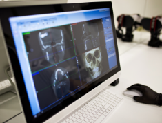Oral surgeon looking at x rays of a patient's jaws on a computer