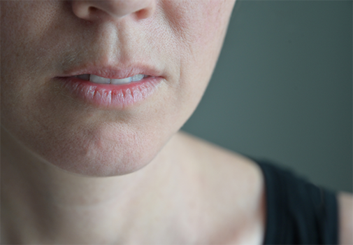 Close up of a person with dry lips