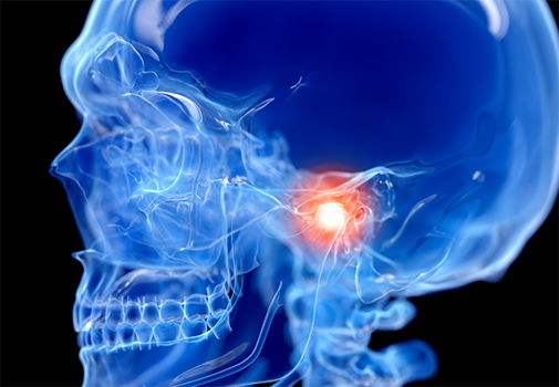 Illustration of the skull with the jaw joint highlighted red