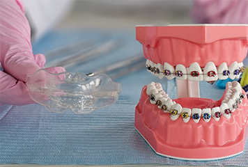 Dentist holding a clear occlusal splint tray next to a model of the teeth